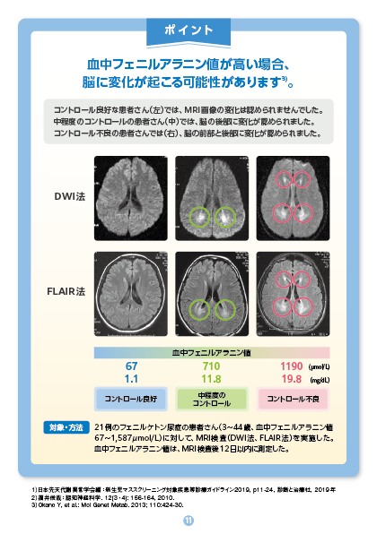 フェニルケトン尿症の治療、大人になったらどうするの？11 血中フェニルアラニン（Phe）濃度が高い状態状態が続くと、脳に影響を与える可能性があります。